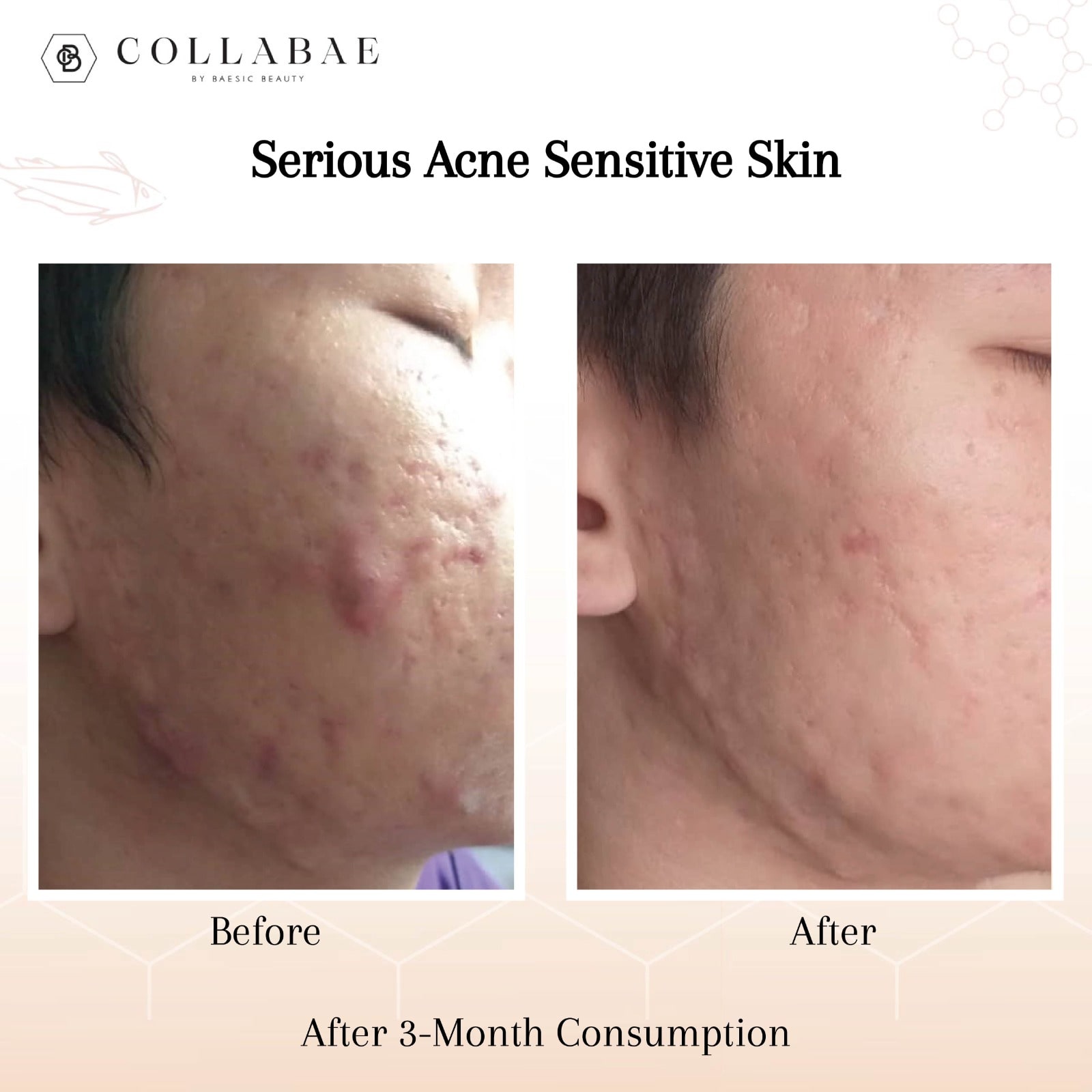 collabae testimonial 00 3 min